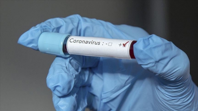 تسجيل 63 اصابة بفيروس كورونا في الاردن منها 59 إصابة محلية