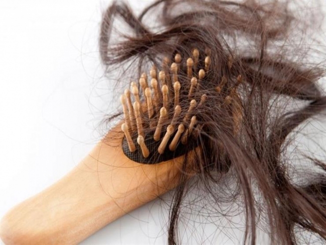تساقط الشعر بين الأسباب و طرق العلاج