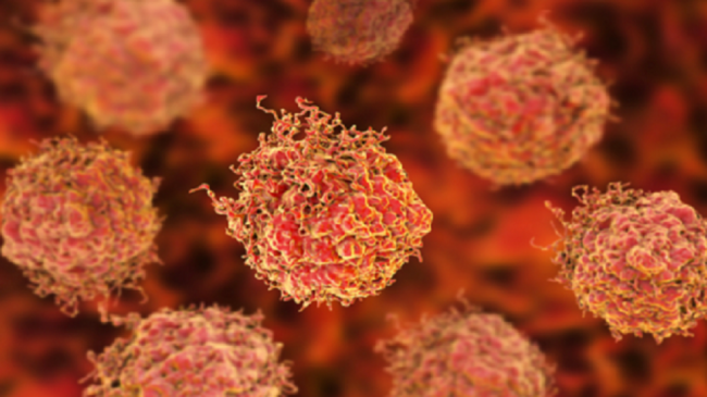 تطوير علاج جديد منقذ للحياة من أحد أكثر أنواع سرطان الدم حدة
