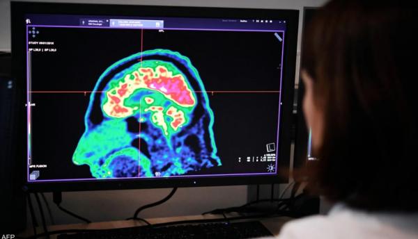 علماء يرصدون نشاط دماغ الإنسان عند الوفاة