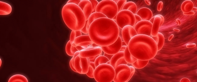 ما هي علامات وأعراض الشعور بجلطة الدم؟