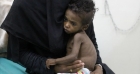 البنك الدولي يمنح اليمن 150 مليون دولار لمواجهة انعدام الأمن الغذائي