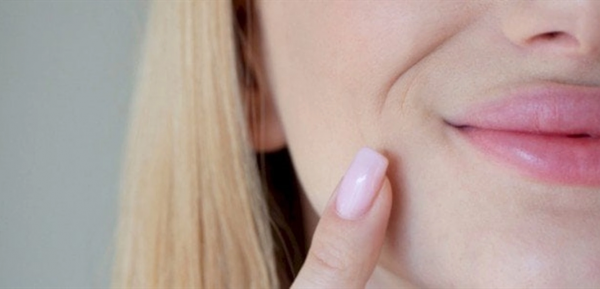 ما الذي يسبب البقع الداكنة حول الفم؟