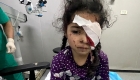 1500 مواطن في قطاع غزة فقدوا البصر جراء حرب الإبادة