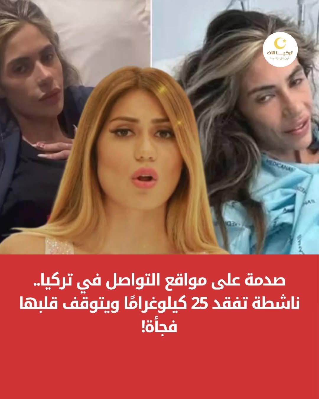 الناشطة التركية المعروفة على مواقع التواصل الاجتماعي نهال جندان تدخل في  مرحلة صحية حرجة