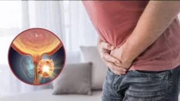 هل التبول الليلي المتكرر علامة على سرطان البروستاتا؟.. مفاجأة