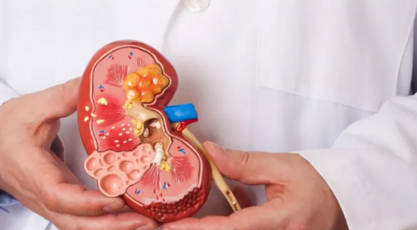 لماذا يعاني مرضى الكلى المتقدم من اضطرابات هضمية خطيرة؟