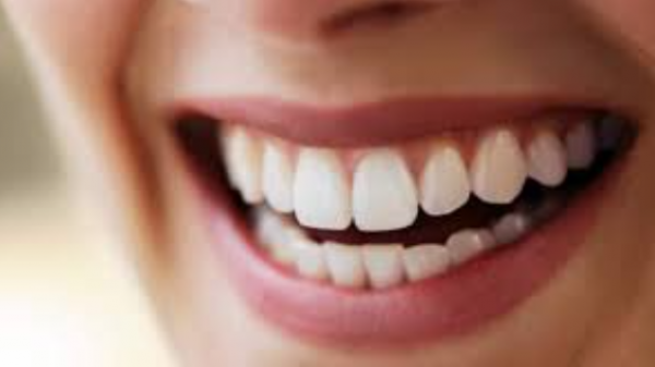 أسرار تبييض الأسنان في المنزل بمكونات بسيطة .. ابتسامة مشرقة وجاذبية لا تُقاوم