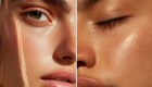 للبشرة مناعتها الخاصة .. وهكذا يتم تعزيزها