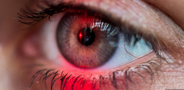 بكتيريا في العين قد تنذر مبكرًا بمرض ألزهايمر