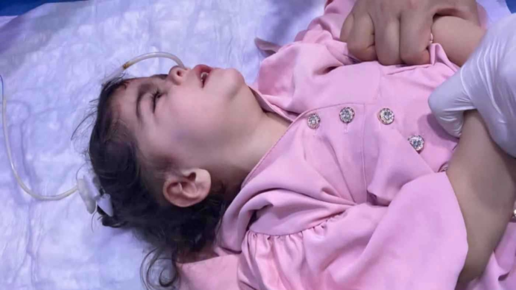 إنقاذ رضيعة تناولت بالخطأ حبوب منع الحمل