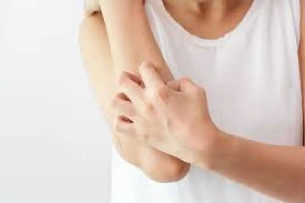 علامات غير شائعة لالتهاب المفاصل