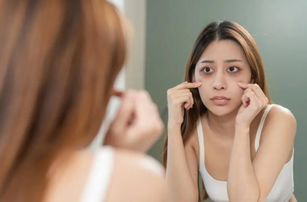 وصفة طبيعية لعلاج الهالات السوداء