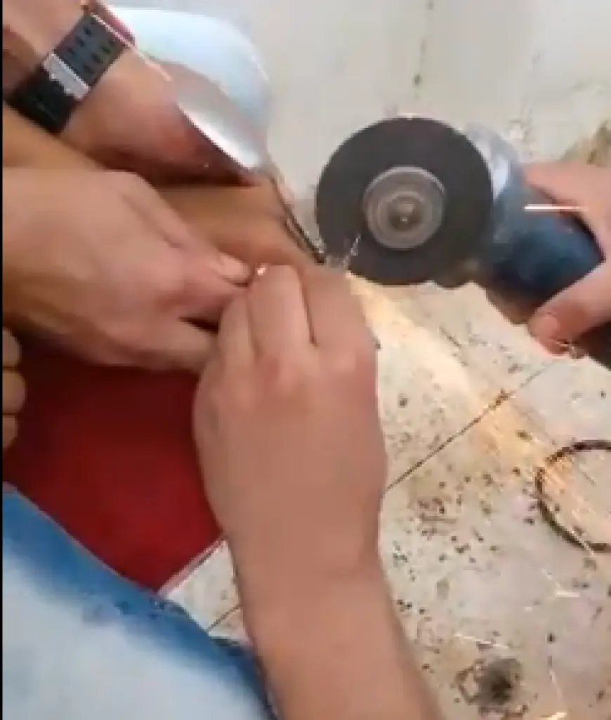 بالفيديو.. هكذا حرر الدفاع المدني اصبع طفل علق بقطعة حديدية