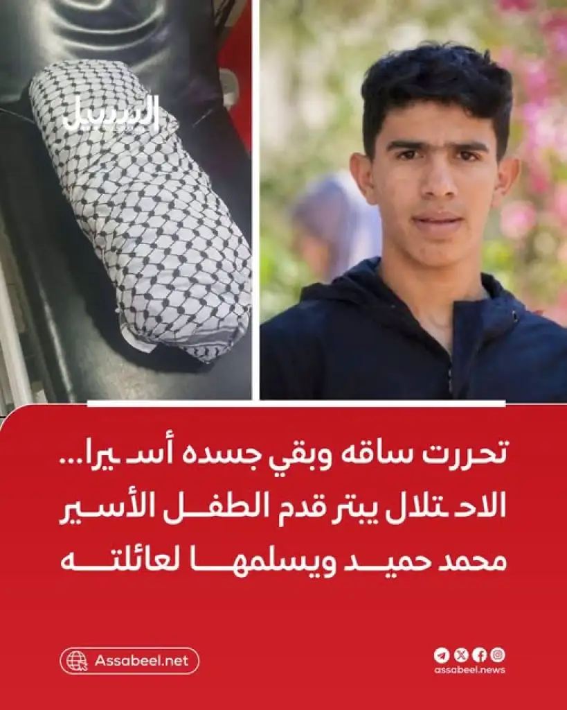 الأسير"الطفل الفلسطيني محمد حميد تحررت ساقه قبل ان يتحرر جسده